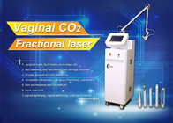 Vagina Tigthing Skin Renewing Remove Scar Fabulous Effective Co2 Fractional Laser Deviced
